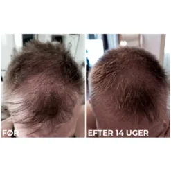 Sanzi Beauty Hair Growth & Enhancing Serum 120 Ml 11 Sanzi Beauty Hair Growth & Enhancing Serum 120 Ml -Nice Hair Butik sanzi beauty hair growth enhancing serum 120 ml 1674212944