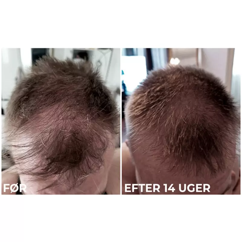 Sanzi Beauty Hair Growth & Enhancing Serum 120 Ml 6 Sanzi Beauty Hair Growth & Enhancing Serum 120 Ml - Billede 6